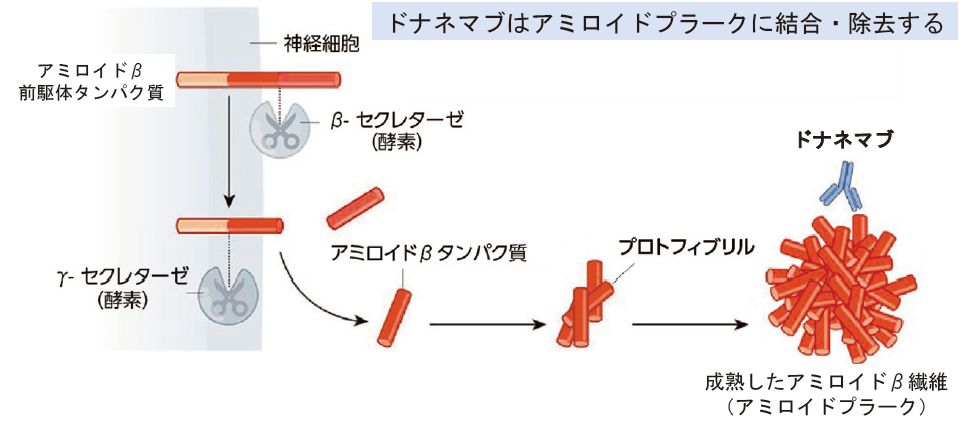 ドナネマブ